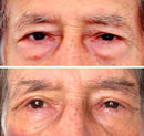 Remove Rugas 2 MINUTOS Instant FIRMx®