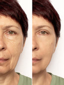 Remove Rugas 2 MINUTOS Instant FIRMx®