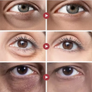 Face lift rejuvenescedor instantâneo