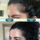 Massageador Elétrico - Renova Hair