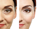 Face lift rejuvenescedor instantâneo