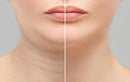 Creme antí-flacidez lifting instantâneo ROLON FIRMx®